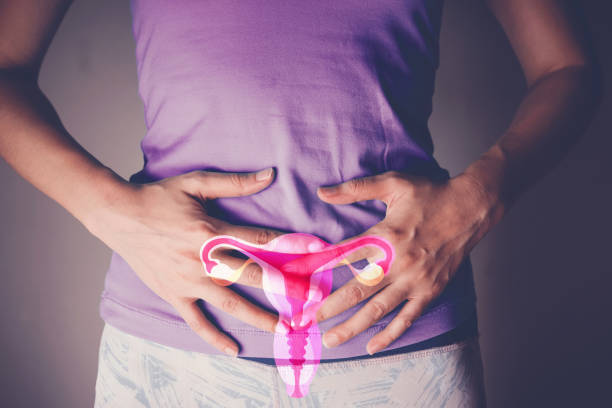 Homeopathy for PCOS and hormonal health — irregular periods and hormonal acne