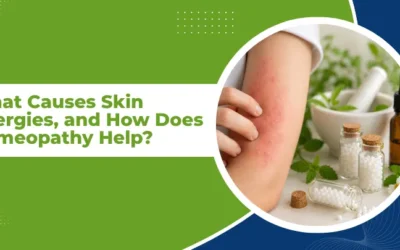 What Causes Skin Allergies, and How Does Homeopathy Help?