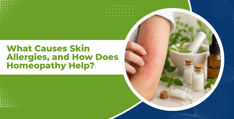 What Causes Skin Allergies, and How Does Homeopathy Help